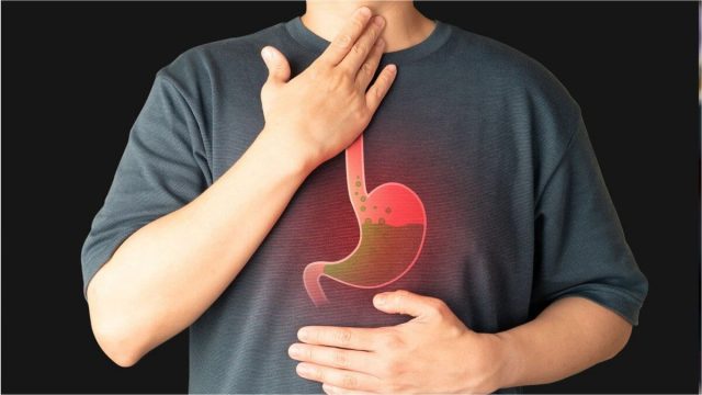 Как избавиться от изжоги без таблеток